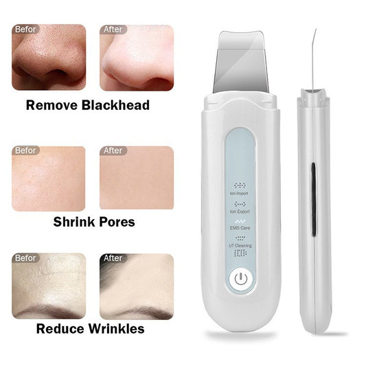 Ultrasonic skin peeling machine